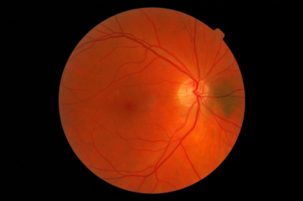 retinal scan